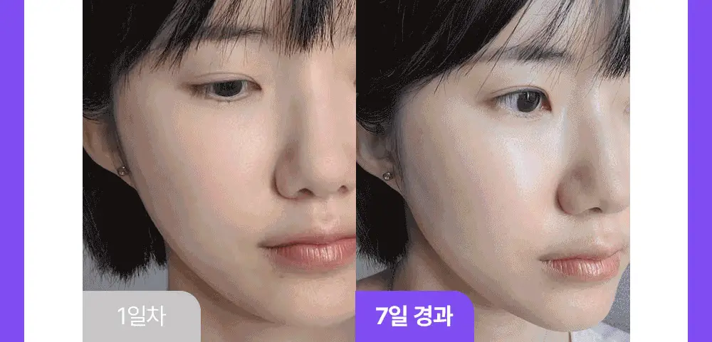 [나띠PICK][잡티케어] 더마펌 수딩 리페어 토닝 세럼 R4 30ml 기획 (+리필 30ml) 상세페이지 24